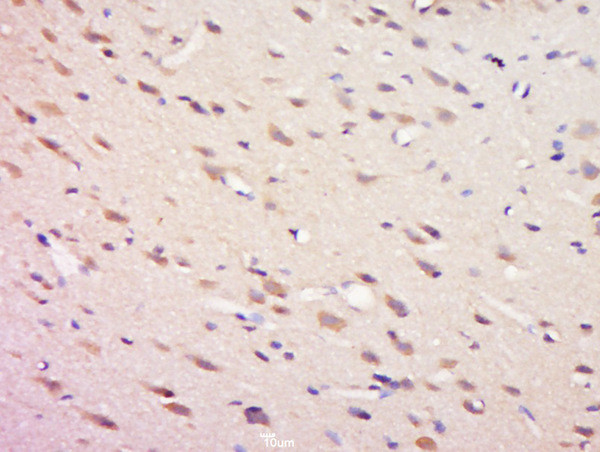 Phospho-SHP2 (Tyr81) Antibody in Immunohistochemistry (Paraffin) (IHC (P))