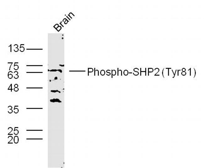 Phospho-SHP2 (Tyr81) Antibody in Western Blot (WB)