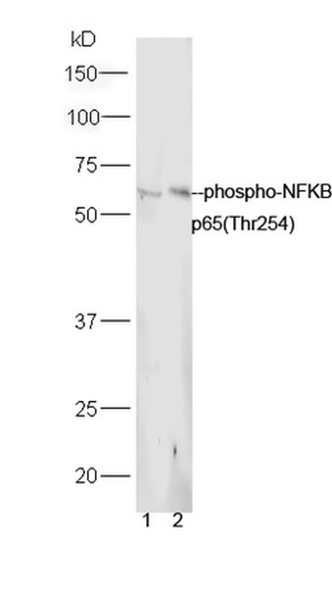 Phospho-NFKB p65 (Thr254) Antibody in Western Blot (WB)