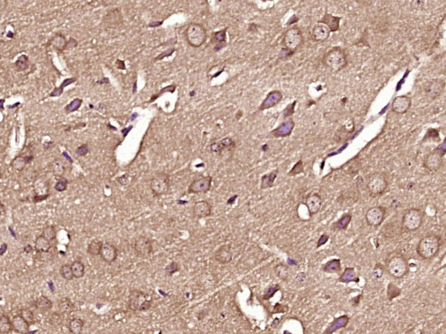 Phospho-RPS6KB1 (Thr412) Antibody in Immunohistochemistry (Paraffin) (IHC (P))