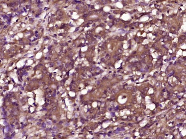 Phospho-RPS6KB1 (Thr412) Antibody in Immunohistochemistry (Paraffin) (IHC (P))