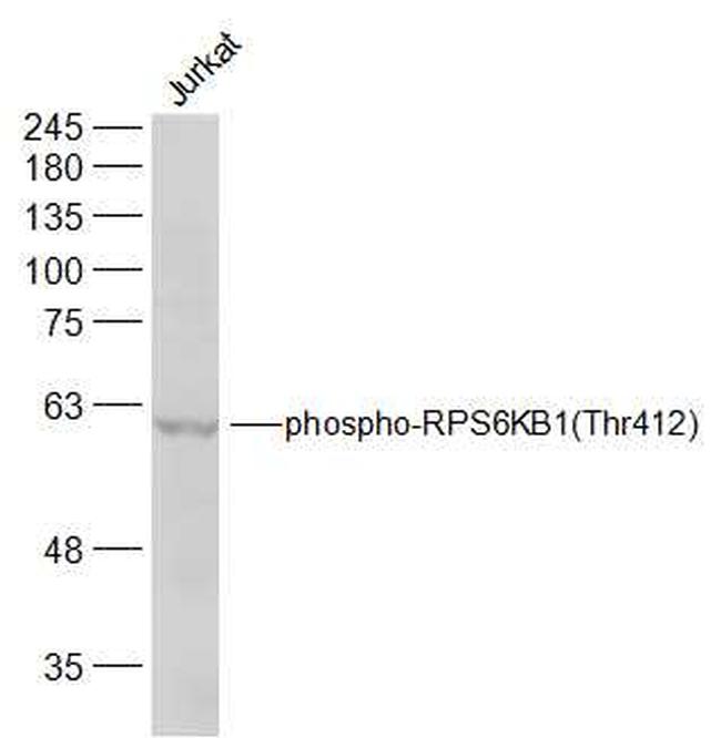 Phospho-RPS6KB1 (Thr412) Antibody in Western Blot (WB)