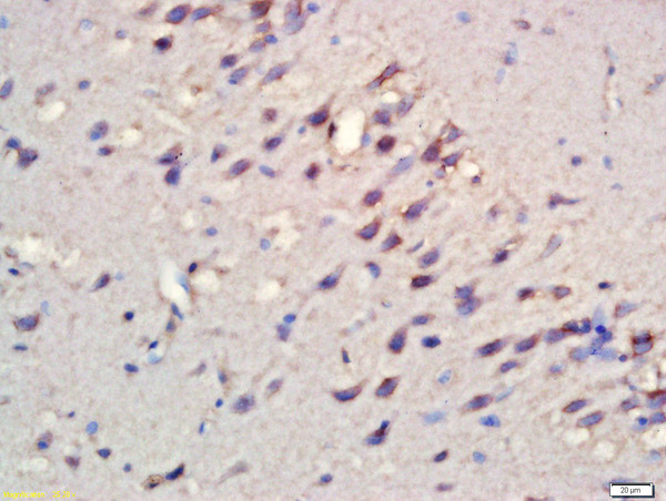 Phospho-RPS6KB1 (Ser427) Antibody in Immunohistochemistry (Paraffin) (IHC (P))