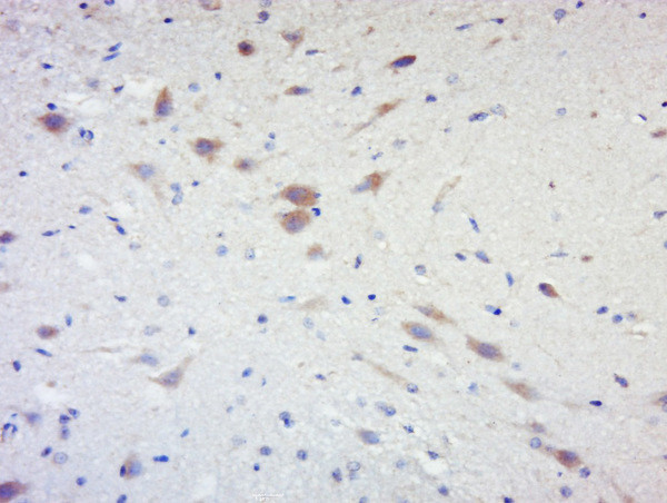 Phospho-RPS6KB1 (Ser441, Thr444) Antibody in Immunohistochemistry (Paraffin) (IHC (P))