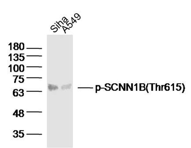 Phospho-SCNN1B (Thr615) Antibody in Western Blot (WB)