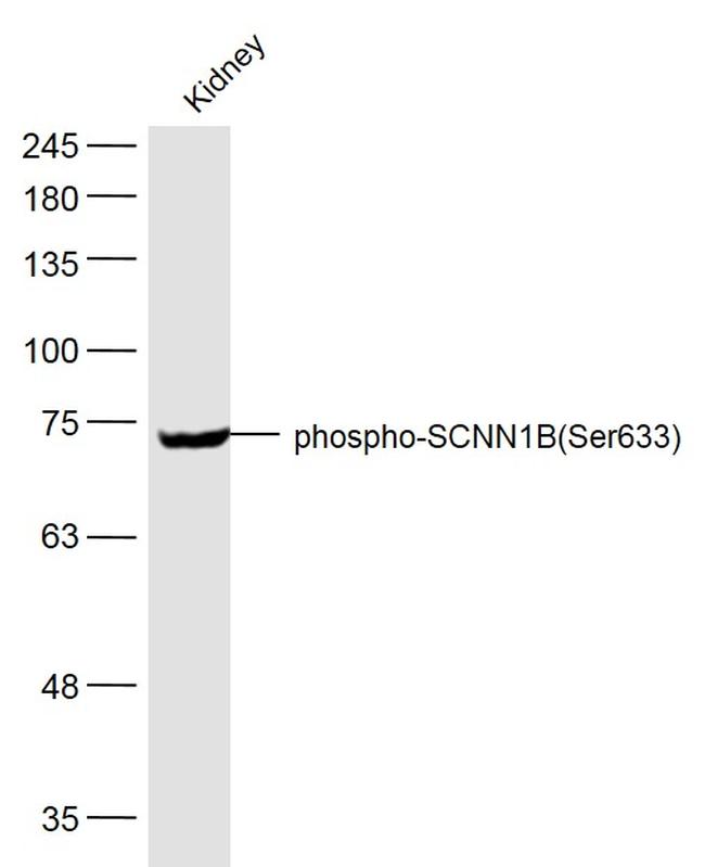 Phospho-SCNN1B (Ser633) Antibody in Western Blot (WB)