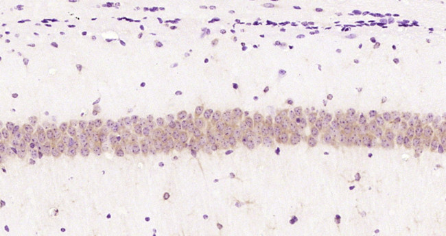 RPL11 Antibody in Immunohistochemistry (Paraffin) (IHC (P))