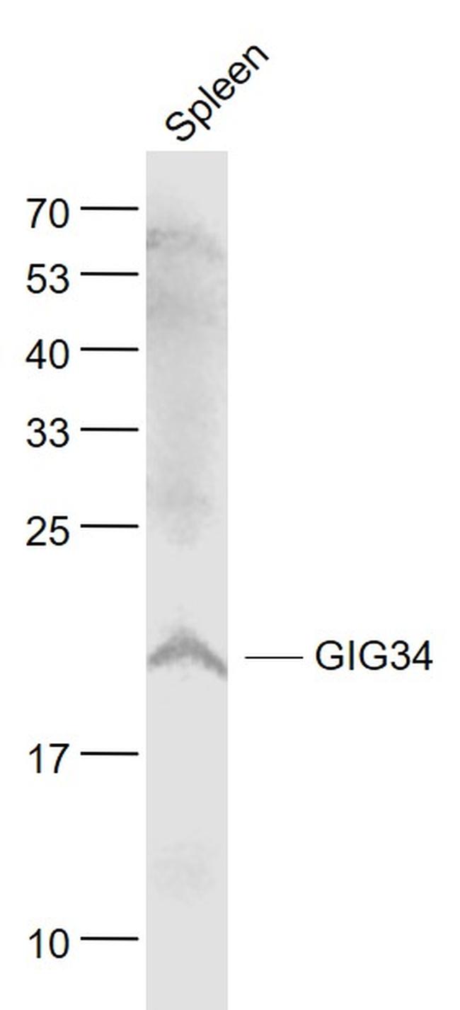 RPL11 Antibody in Western Blot (WB)