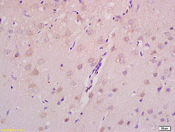 Axin 2 Antibody in Immunohistochemistry (Paraffin) (IHC (P))