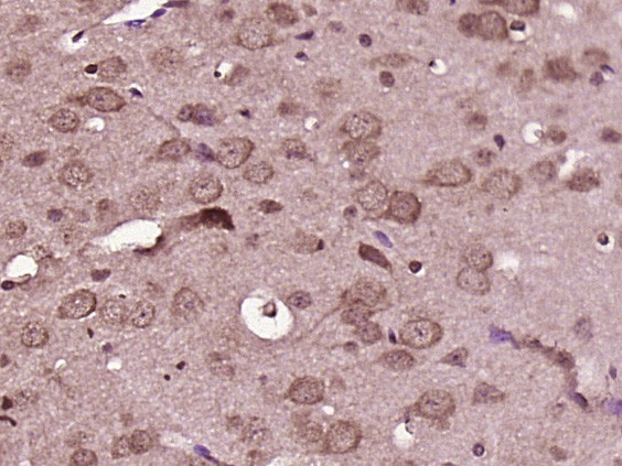 Axin 2 Antibody in Immunohistochemistry (Paraffin) (IHC (P))