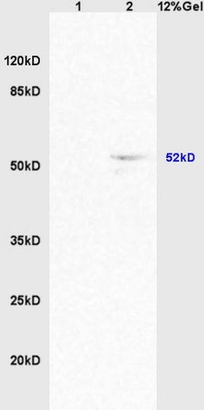 Activin A Receptor Type IC Antibody in Western Blot (WB)