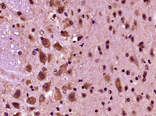 PRODH Antibody in Immunohistochemistry (Paraffin) (IHC (P))