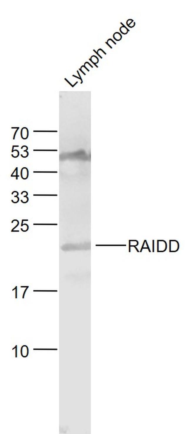 RAIDD Antibody in Western Blot (WB)