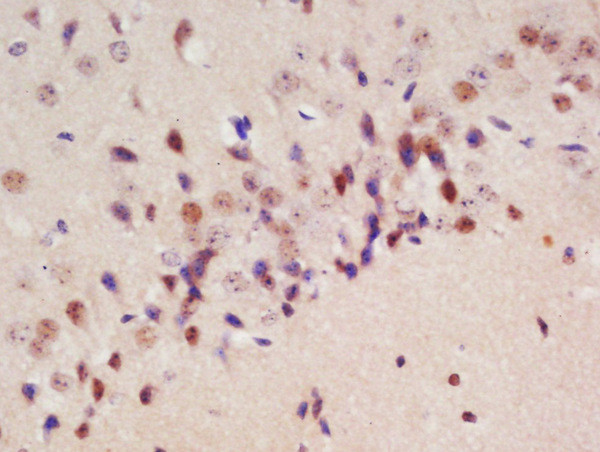 Drebrin Antibody in Immunohistochemistry (Paraffin) (IHC (P))