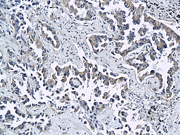 ESAM Antibody in Immunohistochemistry (Paraffin) (IHC (P))