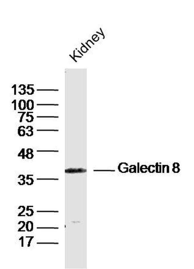 Galectin 8 Antibody in Western Blot (WB)