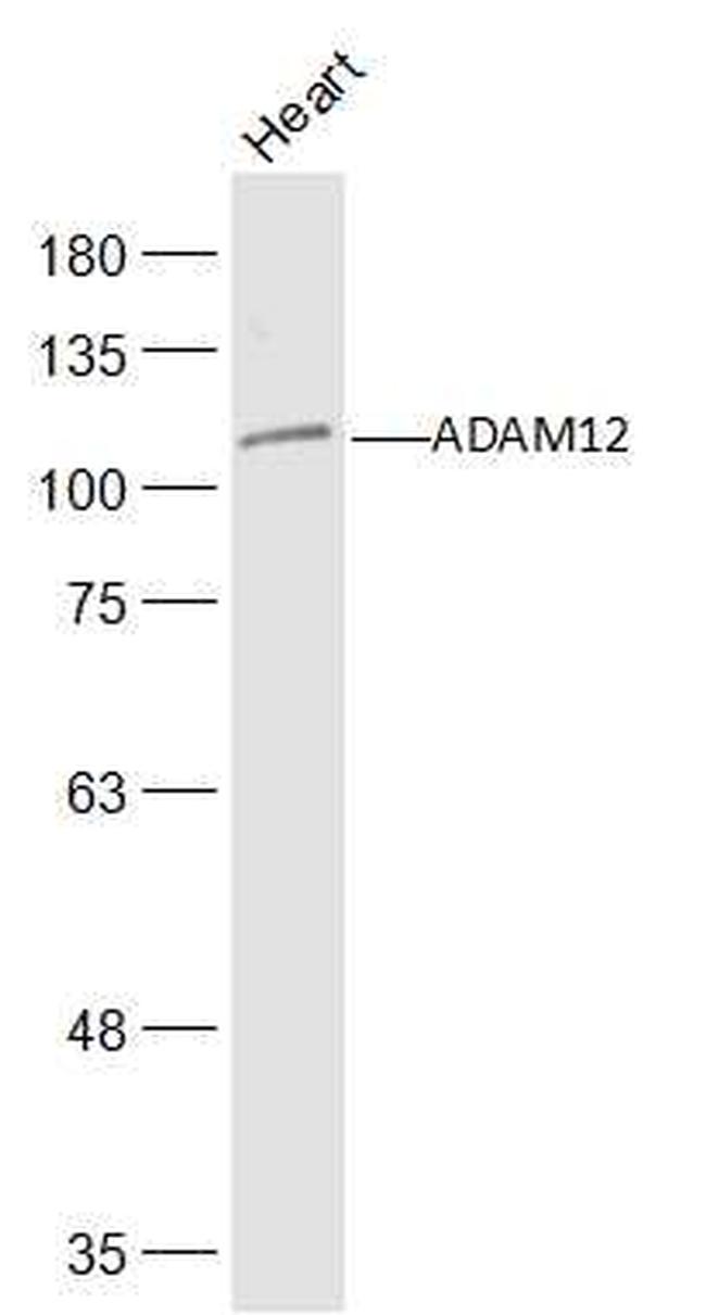 ADAM12 Antibody in Western Blot (WB)