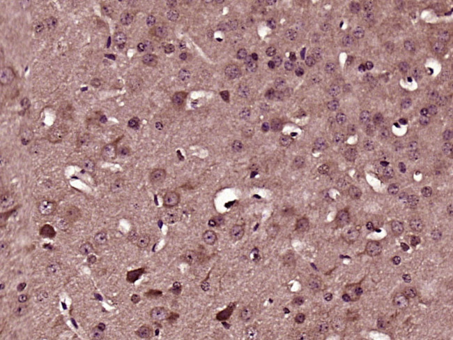 ADAM23 Antibody in Immunohistochemistry (Paraffin) (IHC (P))