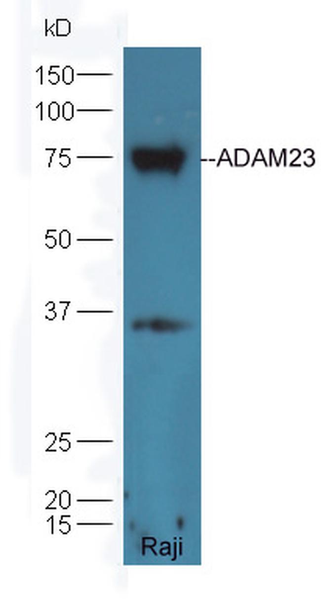 ADAM23 Antibody in Western Blot (WB)