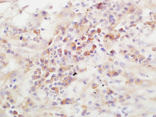 ADAMTS13 Antibody in Immunohistochemistry (Paraffin) (IHC (P))