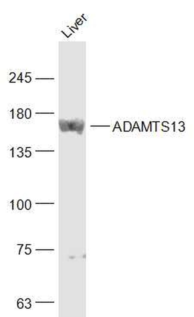 ADAMTS13 Antibody in Western Blot (WB)