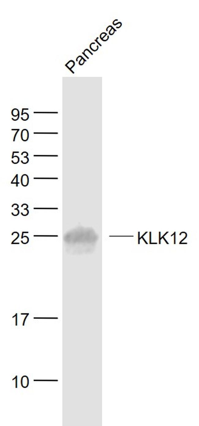 KLK12 Antibody in Western Blot (WB)