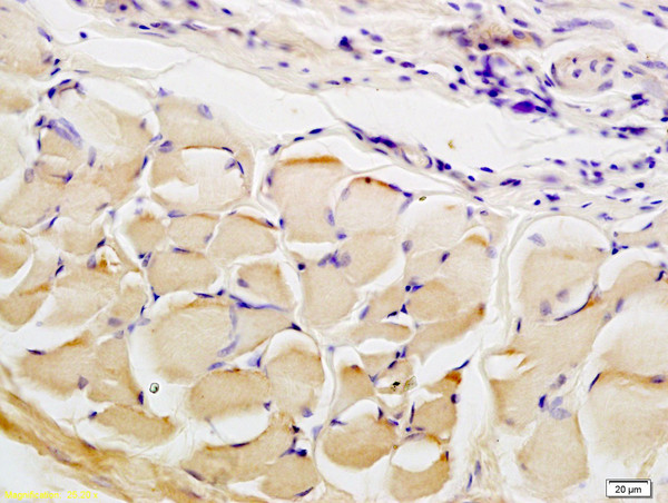 CTHRC1 Antibody in Immunohistochemistry (Paraffin) (IHC (P))