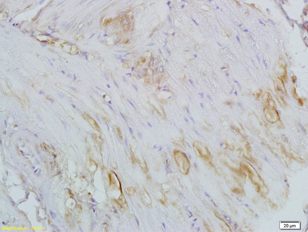 CTHRC1 Antibody in Immunohistochemistry (Paraffin) (IHC (P))