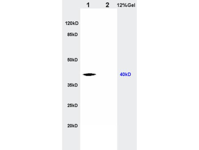 CTHRC1 Antibody in Western Blot (WB)