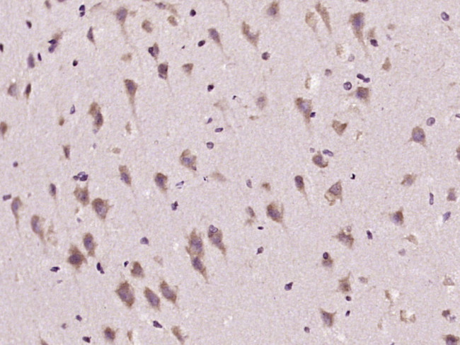 ADORA2B Antibody in Immunohistochemistry (Paraffin) (IHC (P))