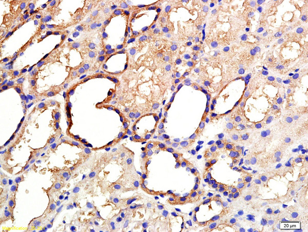 ANGPTL3 Antibody in Immunohistochemistry (Paraffin) (IHC (P))