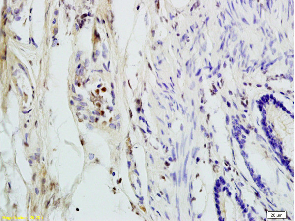 ANP32C Antibody in Immunohistochemistry (Paraffin) (IHC (P))