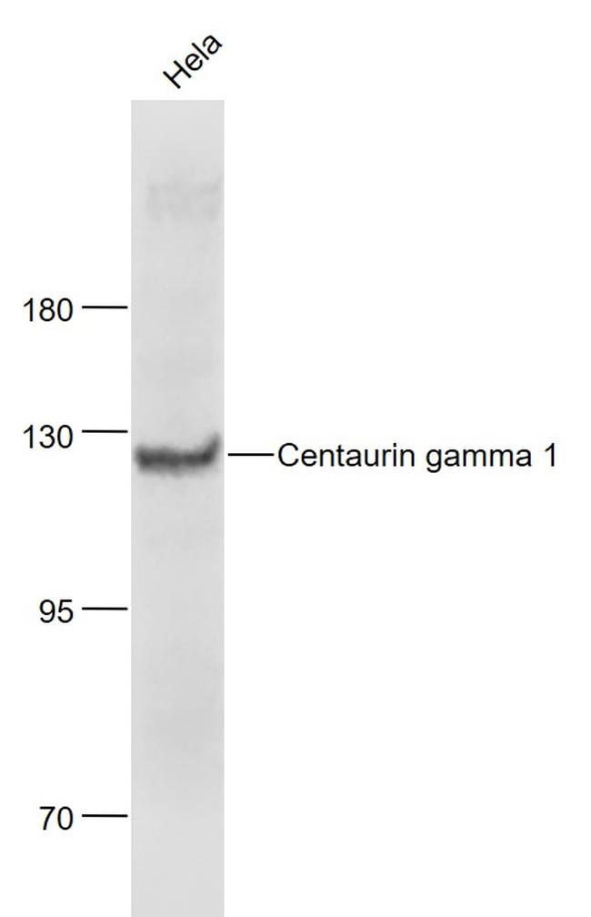 Centaurin gamma 1 Antibody in Western Blot (WB)