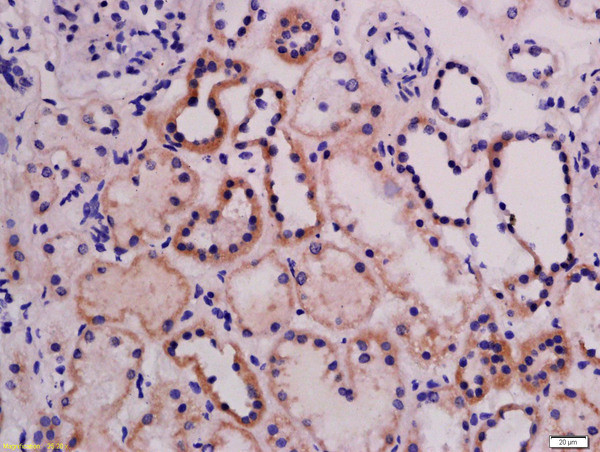 ABI3 Antibody in Immunohistochemistry (Paraffin) (IHC (P))