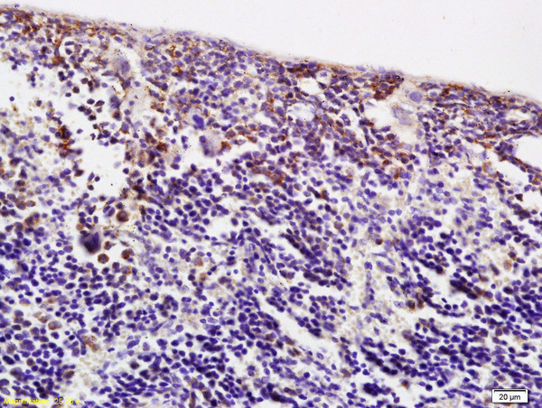 ACBD6 Antibody in Immunohistochemistry (Paraffin) (IHC (P))