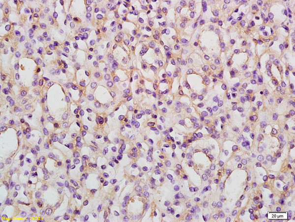 ACVR1B Antibody in Immunohistochemistry (Paraffin) (IHC (P))