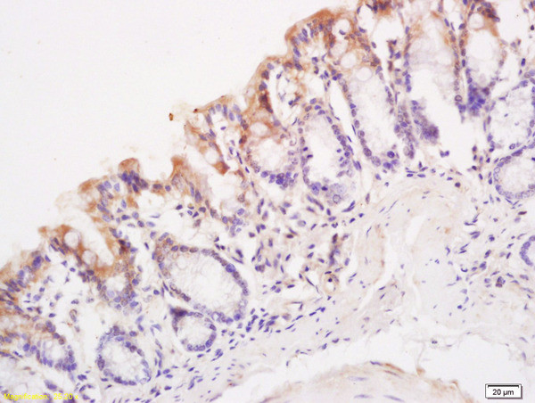 TSLC1 Antibody in Immunohistochemistry (Paraffin) (IHC (P))