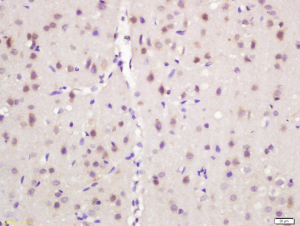 NARC1 Antibody in Immunohistochemistry (Paraffin) (IHC (P))