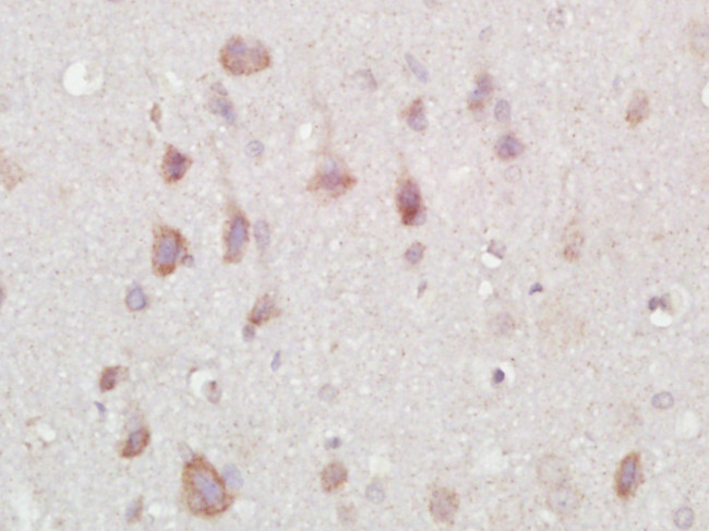 NARC1 Antibody in Immunohistochemistry (Paraffin) (IHC (P))