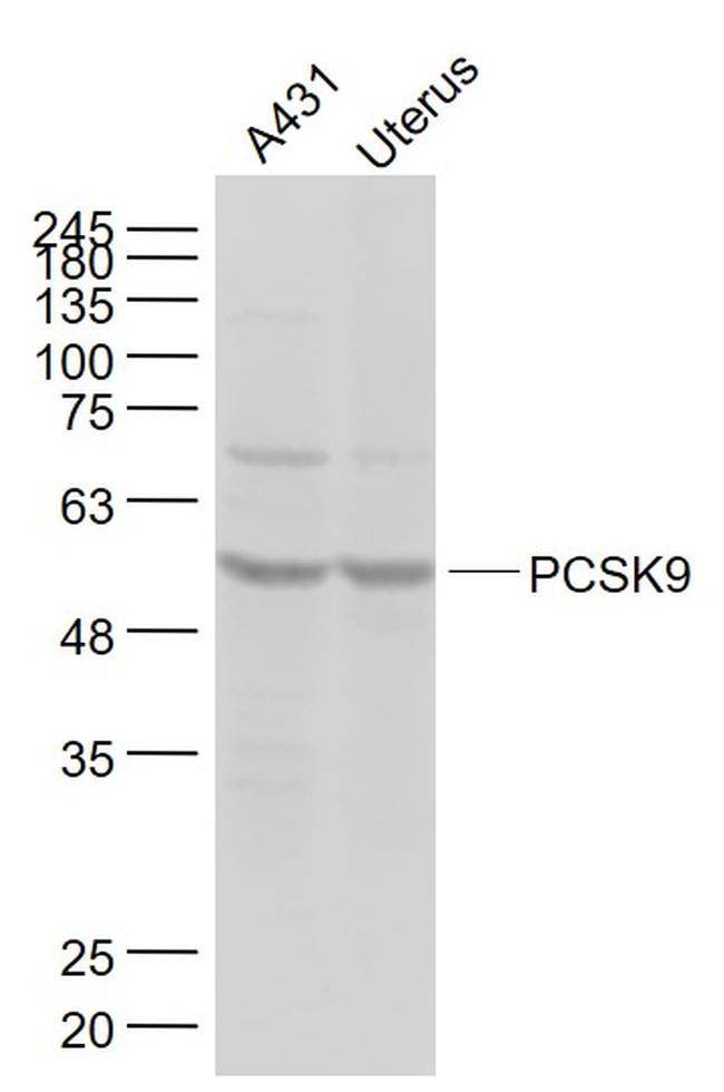 NARC1 Antibody in Western Blot (WB)