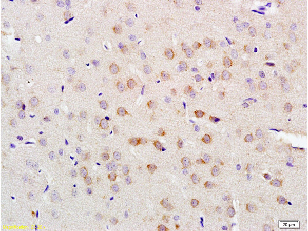 LLGL1 Antibody in Immunohistochemistry (Paraffin) (IHC (P))