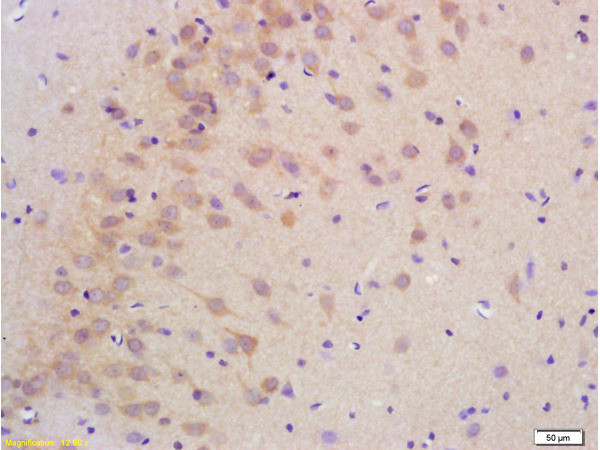 Phospho-LLGL1/LLGL2 (Ser650, Ser654) Antibody in Immunohistochemistry (Paraffin) (IHC (P))