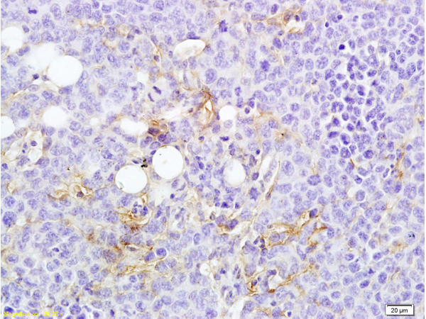 MTUS1 Antibody in Immunohistochemistry (Paraffin) (IHC (P))