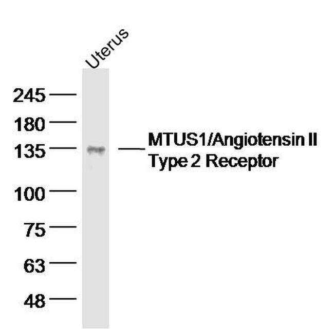 MTUS1 Antibody in Western Blot (WB)