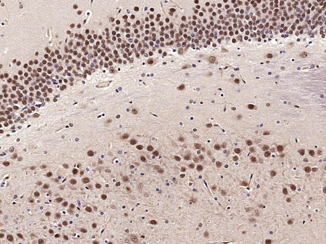 PHAP Antibody in Immunohistochemistry (Paraffin) (IHC (P))