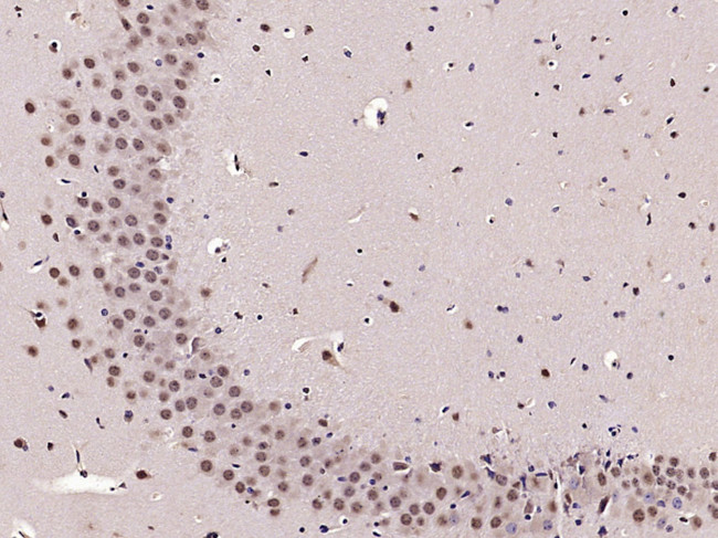 PHAP Antibody in Immunohistochemistry (Paraffin) (IHC (P))