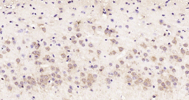 RSRC2 Antibody in Immunohistochemistry (Paraffin) (IHC (P))