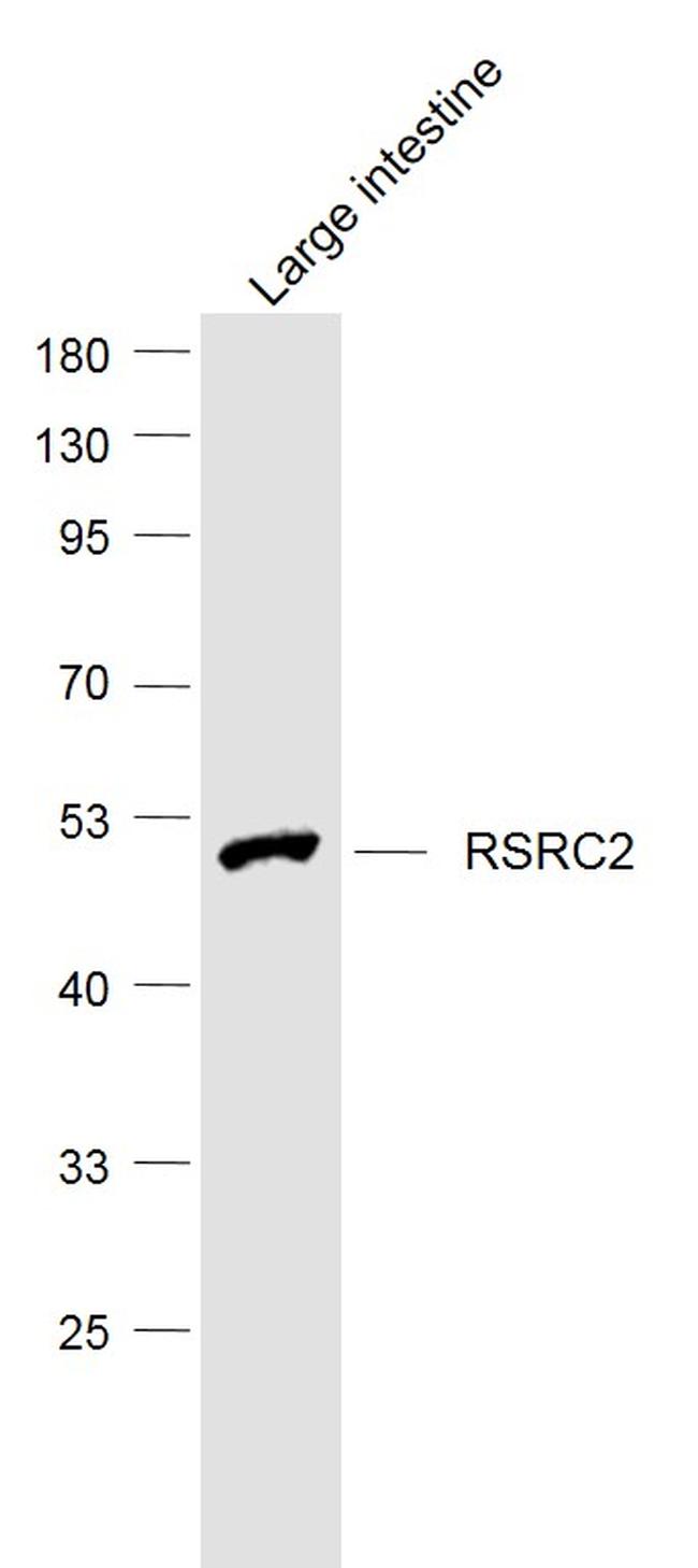 RSRC2 Antibody in Western Blot (WB)