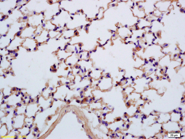 SEZ6L Antibody in Immunohistochemistry (Paraffin) (IHC (P))