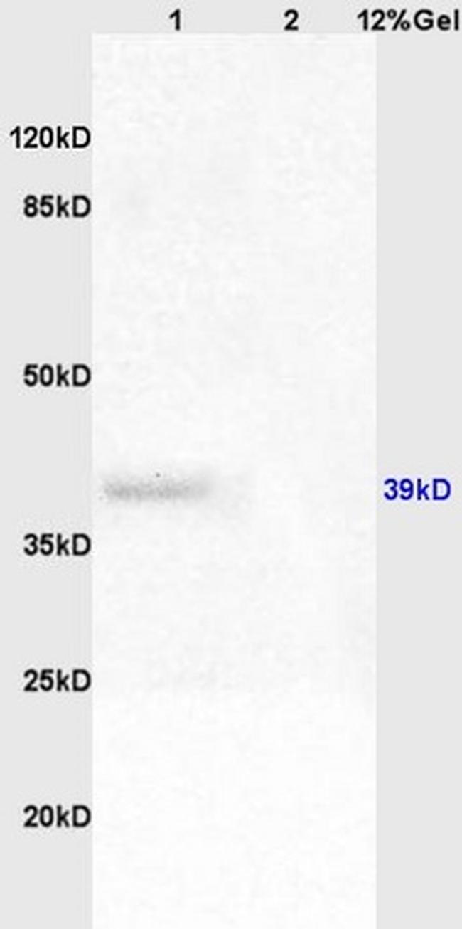 Adenovirus 5 E1A Antibody in Western Blot (WB)